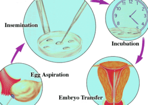 ivf_process