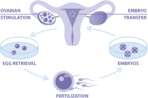 lesbian-ivf-treatment-diagram